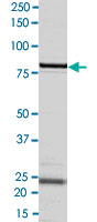 2 &mu;g/lane SDS-PAGE Stained with Coomassie Blue